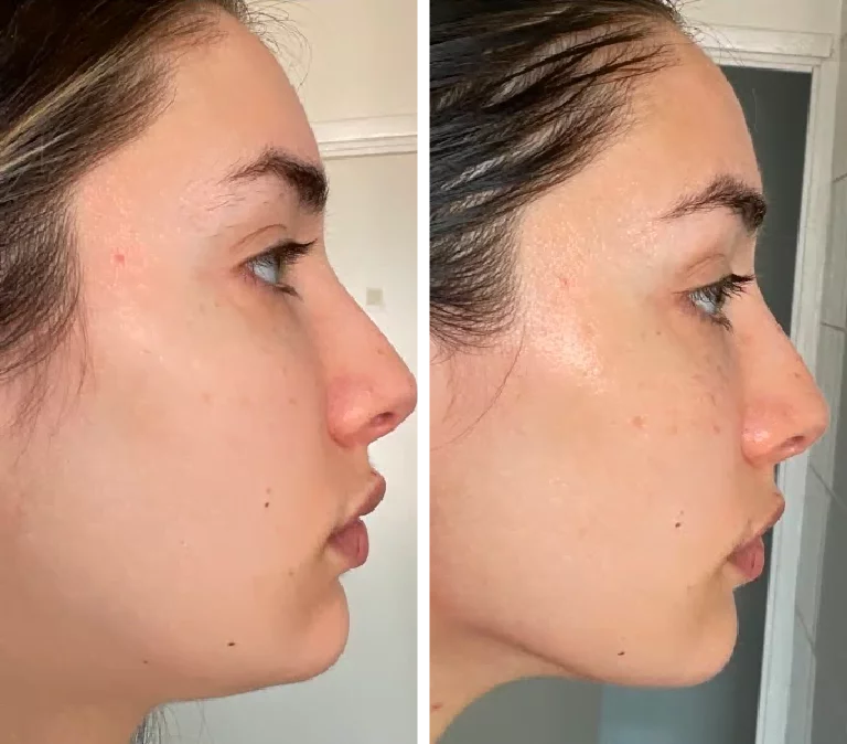 Saw Less Puffiness