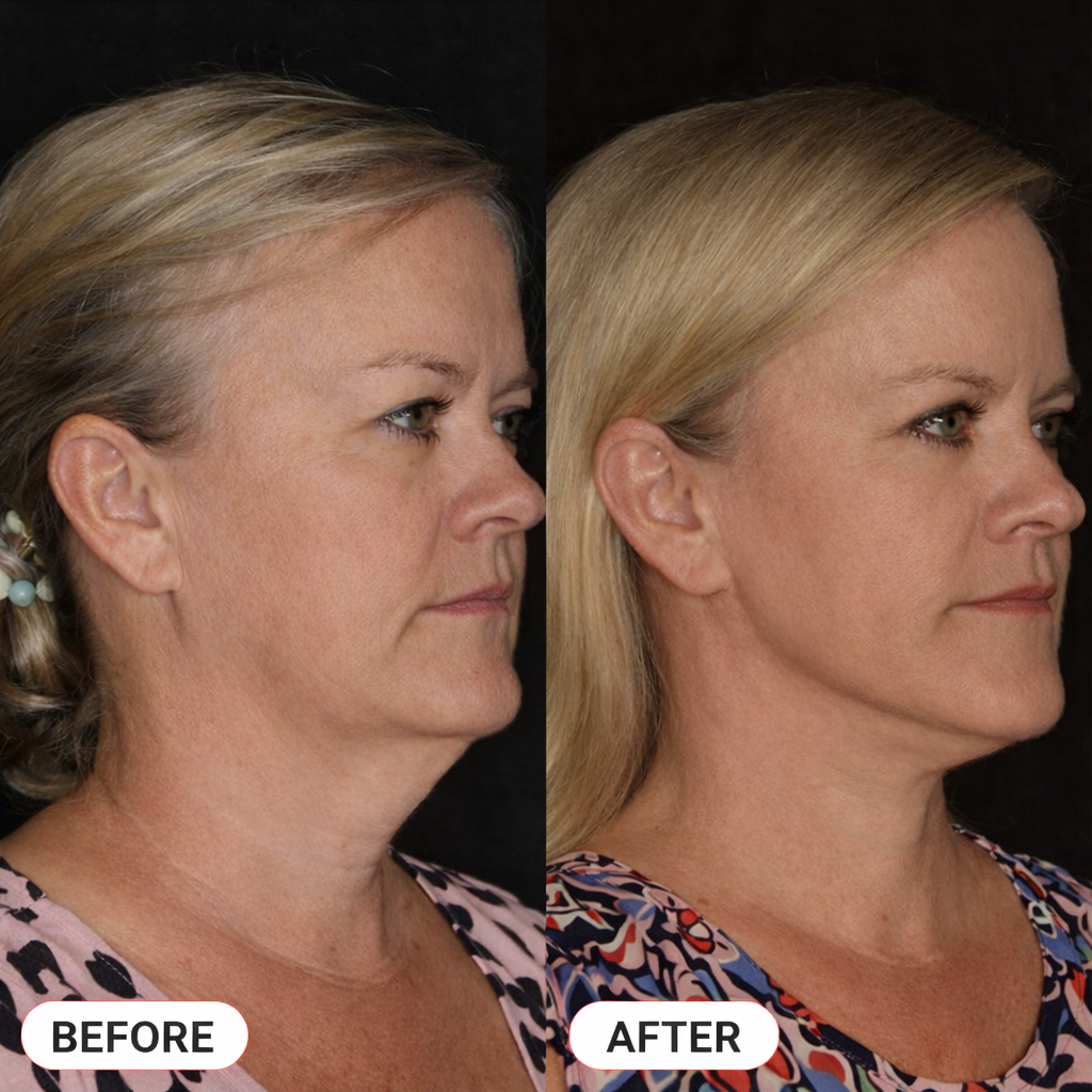 Heroptimal 3-in-1 Sculpt Wand