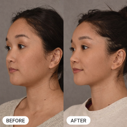 Heroptimal 3-in-1 Sculpt Wand